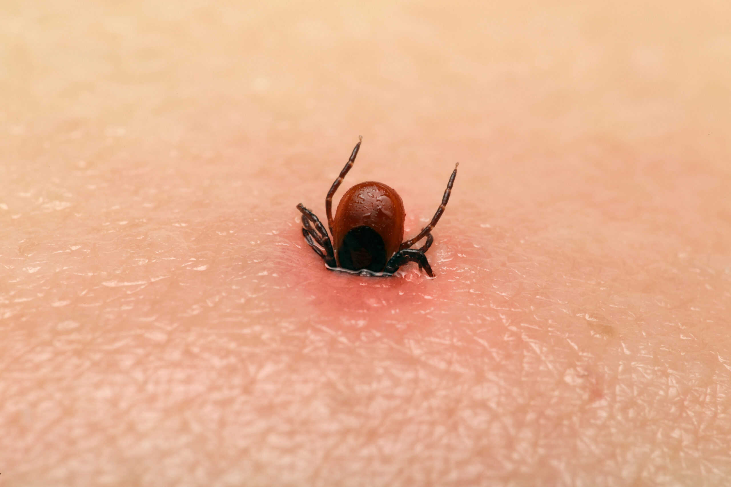 Tick-Borne Virus Discovered in China Affects Your Brain