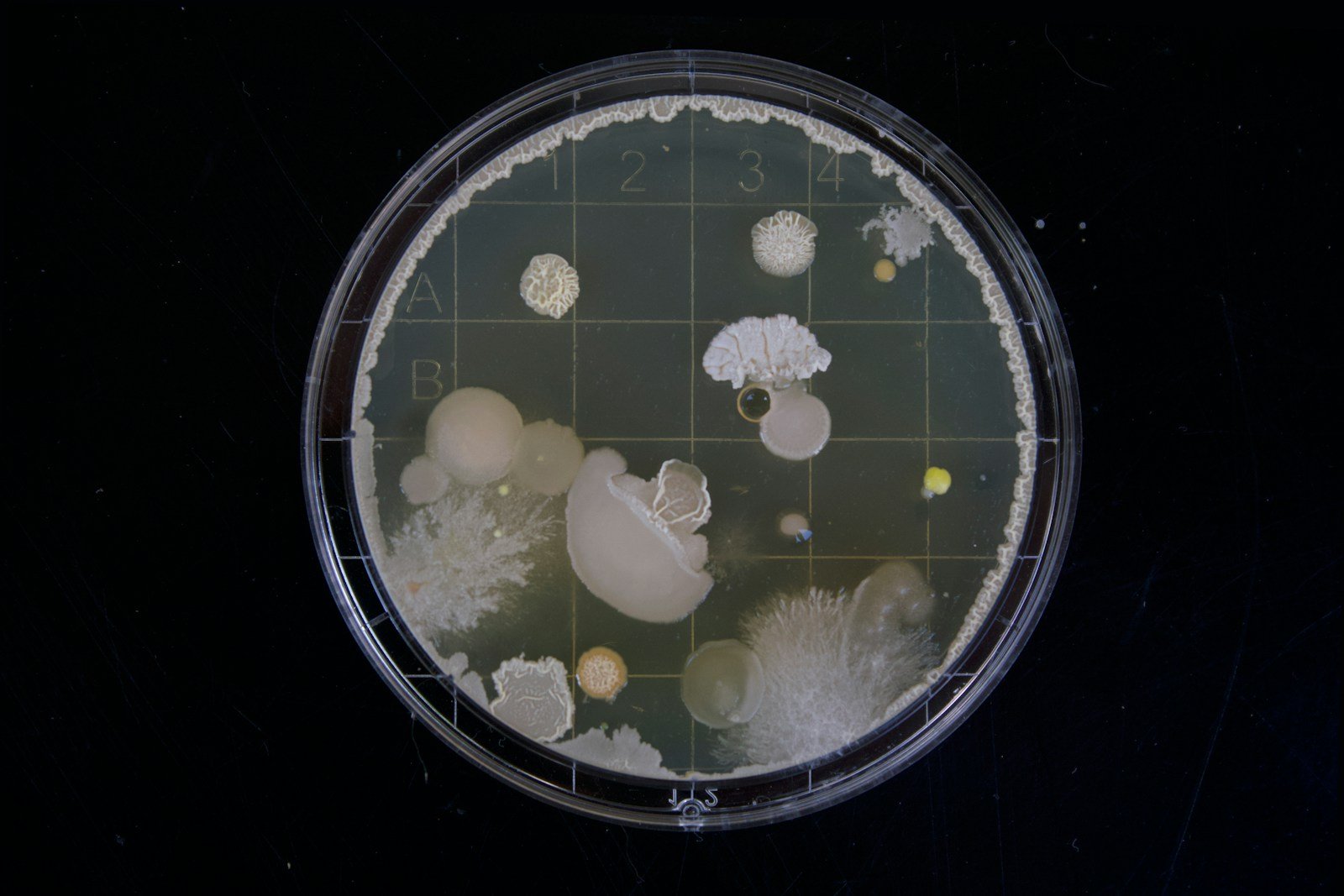 A microscopic view of bacteria.
