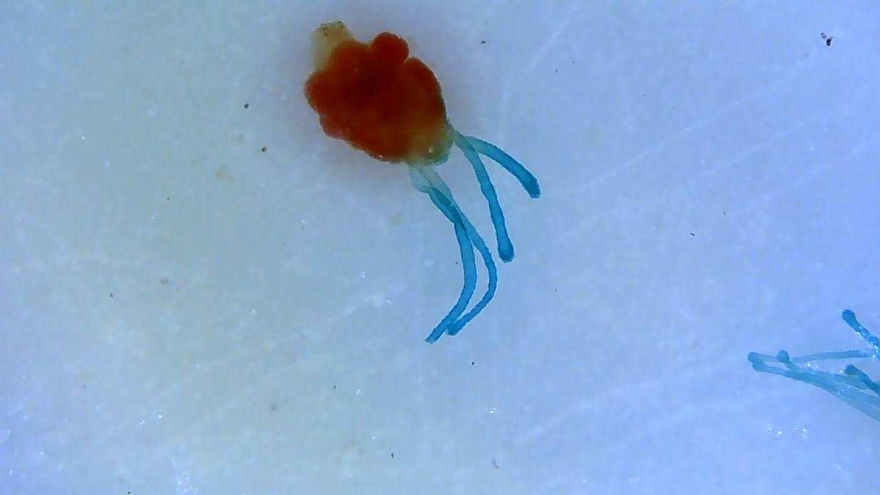 Hydra: The Ever-Youthful Polyp