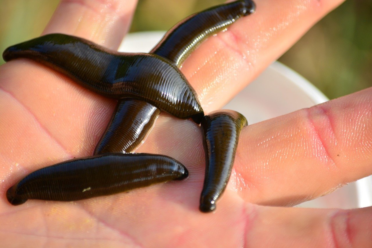 The Healing Power of Leeches