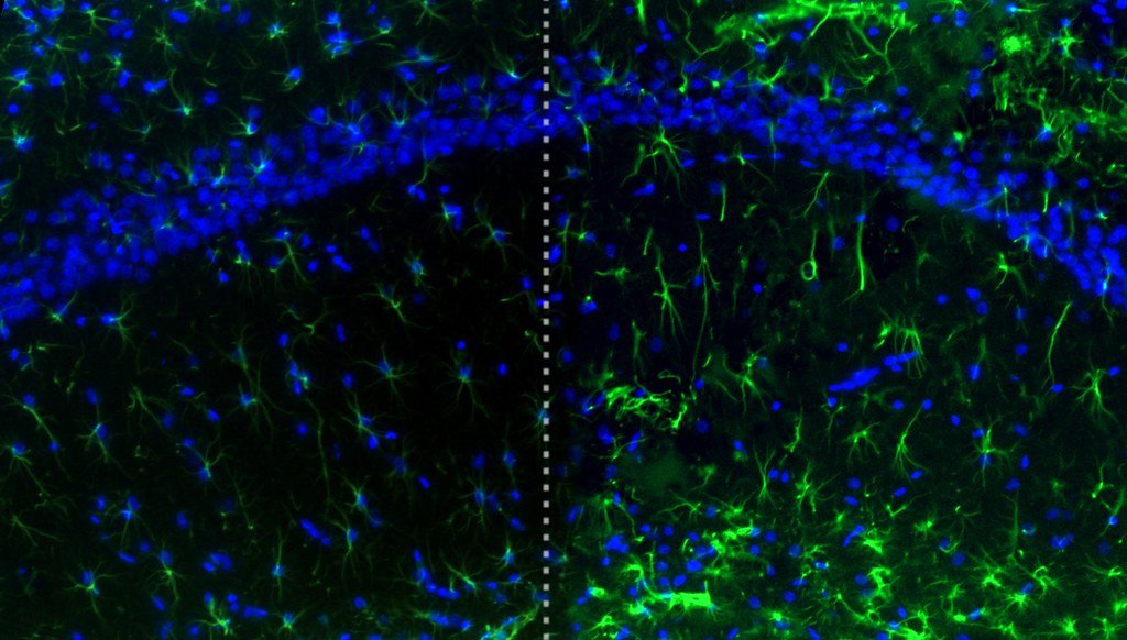 Alcohol and Astrocytes.