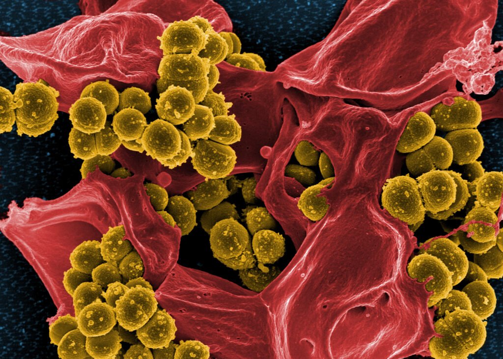 Scanning electron micrograph of Methicillin resistant 