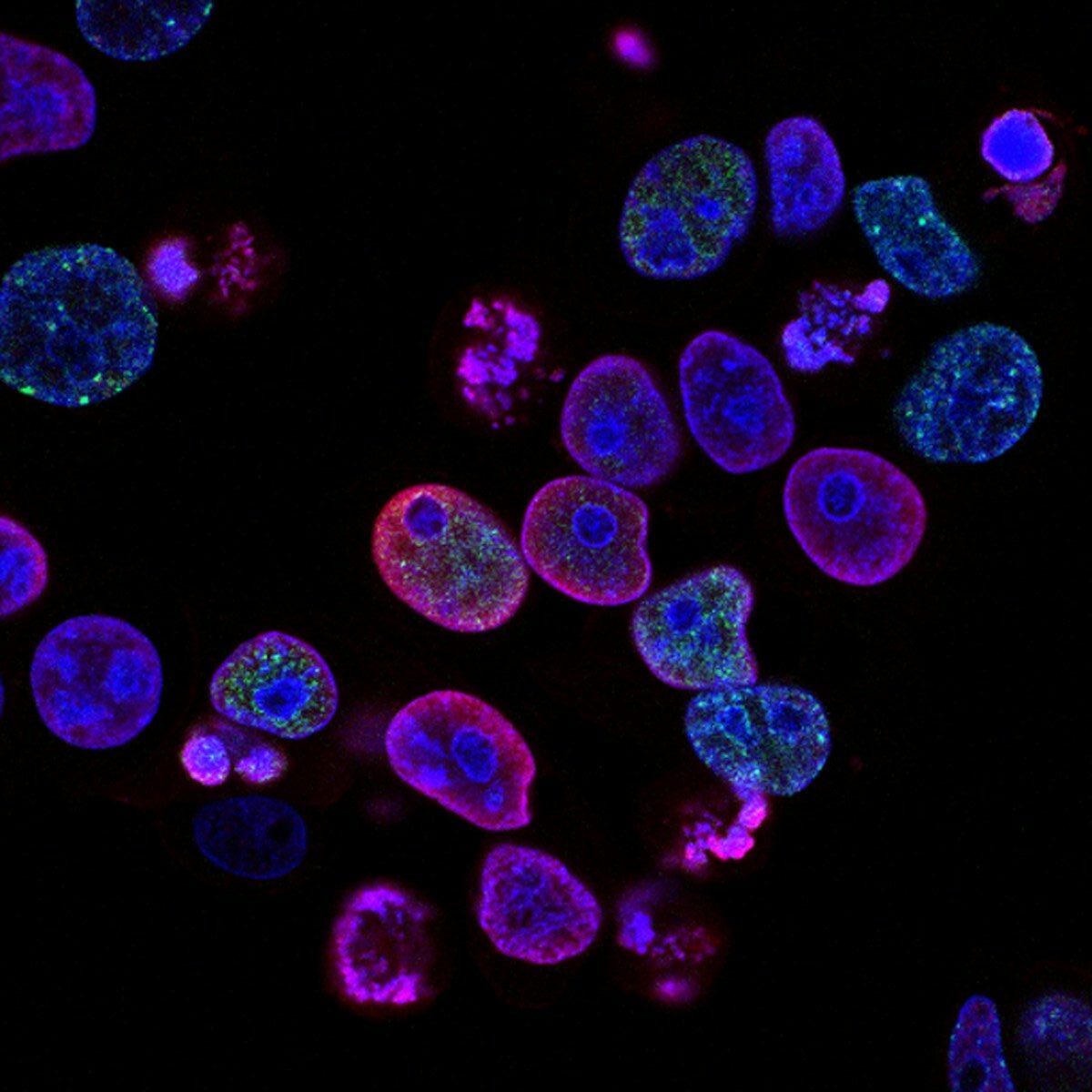 Flow Cytometry: The Unsung Hero of Modern Biology and Its Role in Cancer Research