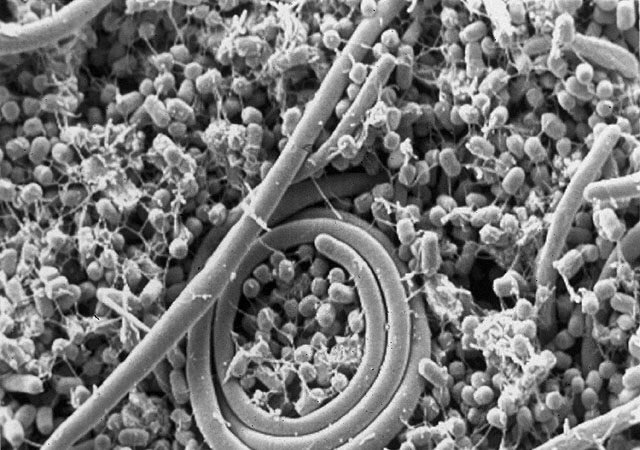 The Science Behind Bacterial Intelligence