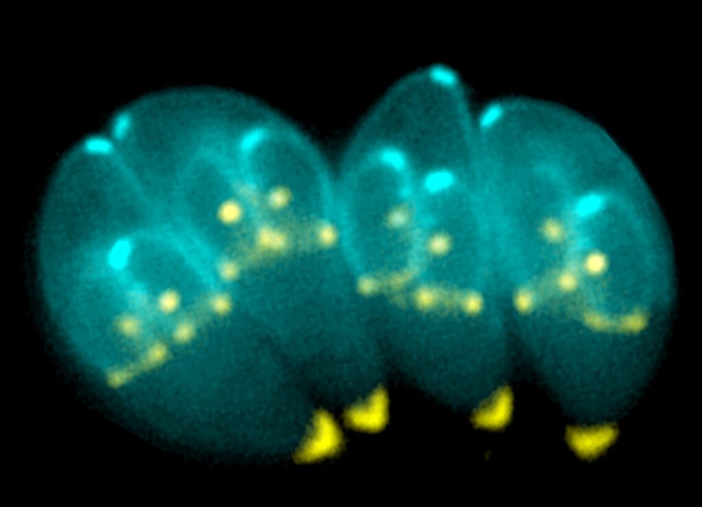 Meet Toxoplasma gondii: The Brain Invader