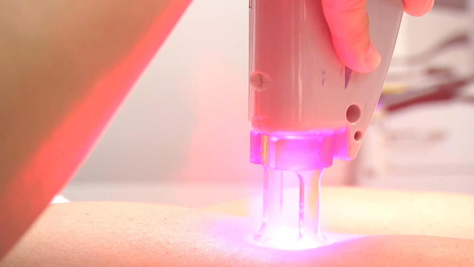 The Role of Laser Manipulation in Medicine (image credits: wikimedia)