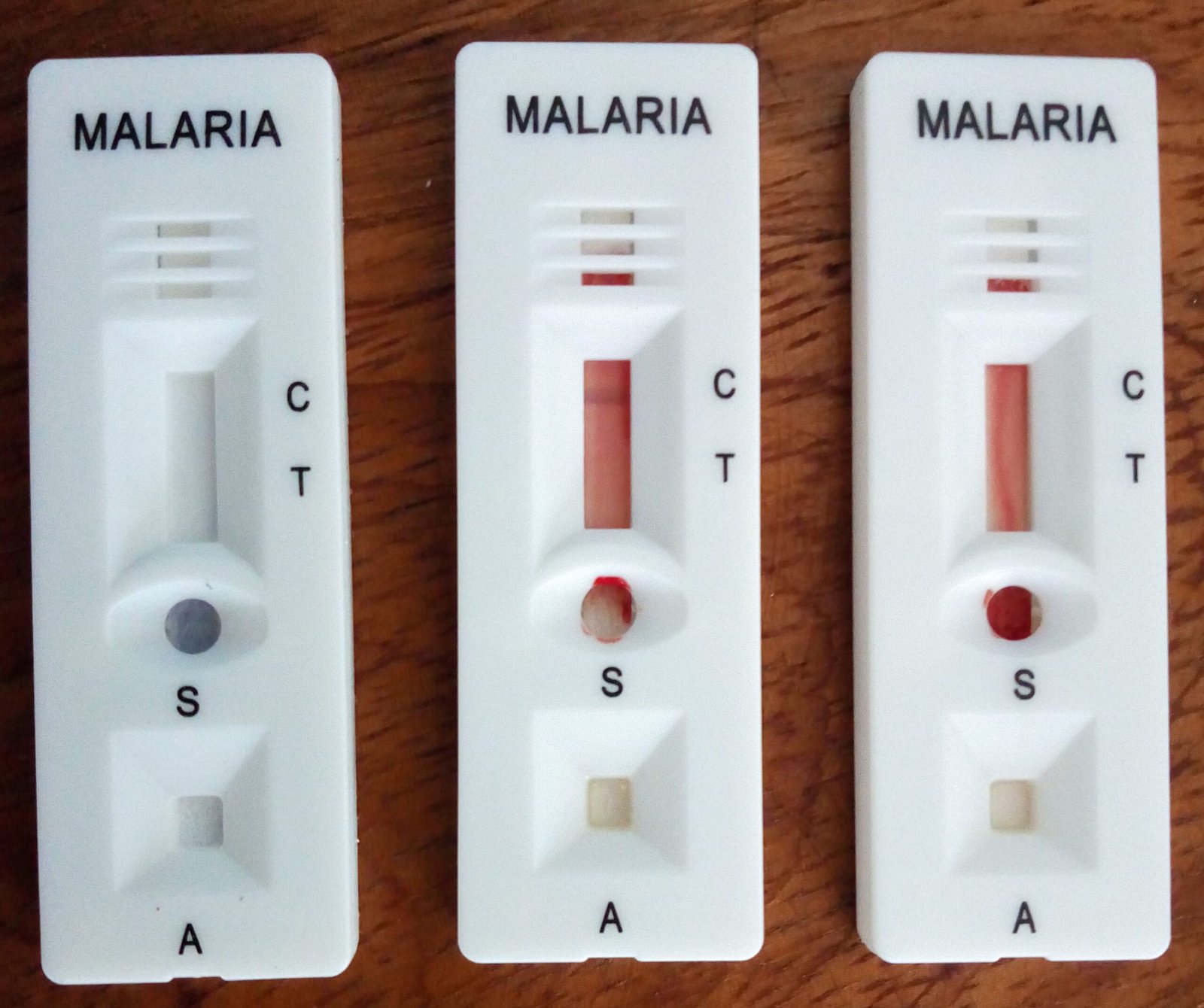 Malaria’s Mark on the Human Genome (image credits: wikimedia)