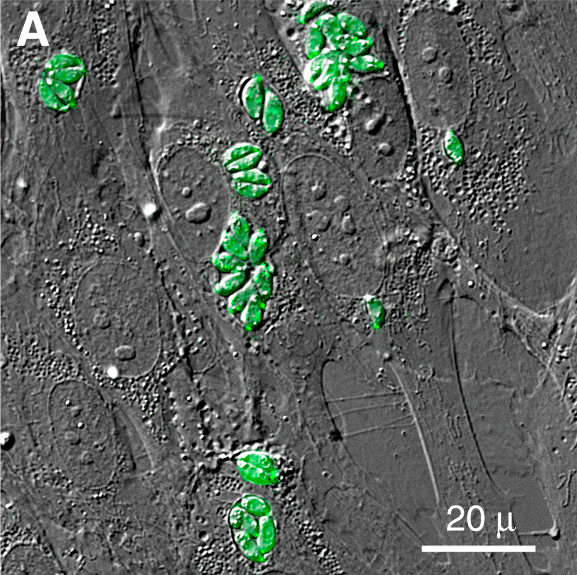 Mind-Altering Toxoplasma (image credits: wikimedia)