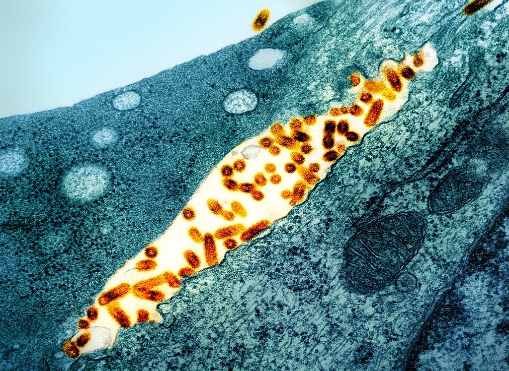 Vesicular Stomatitis Virus