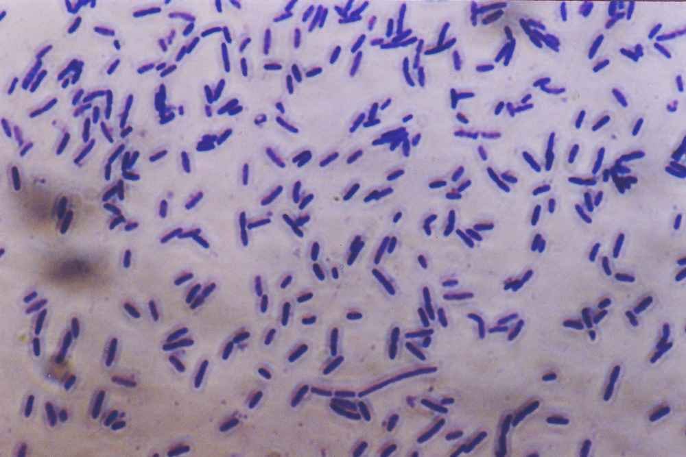 Innovative Applications of Bacterial Textiles (image credits: wikimedia)