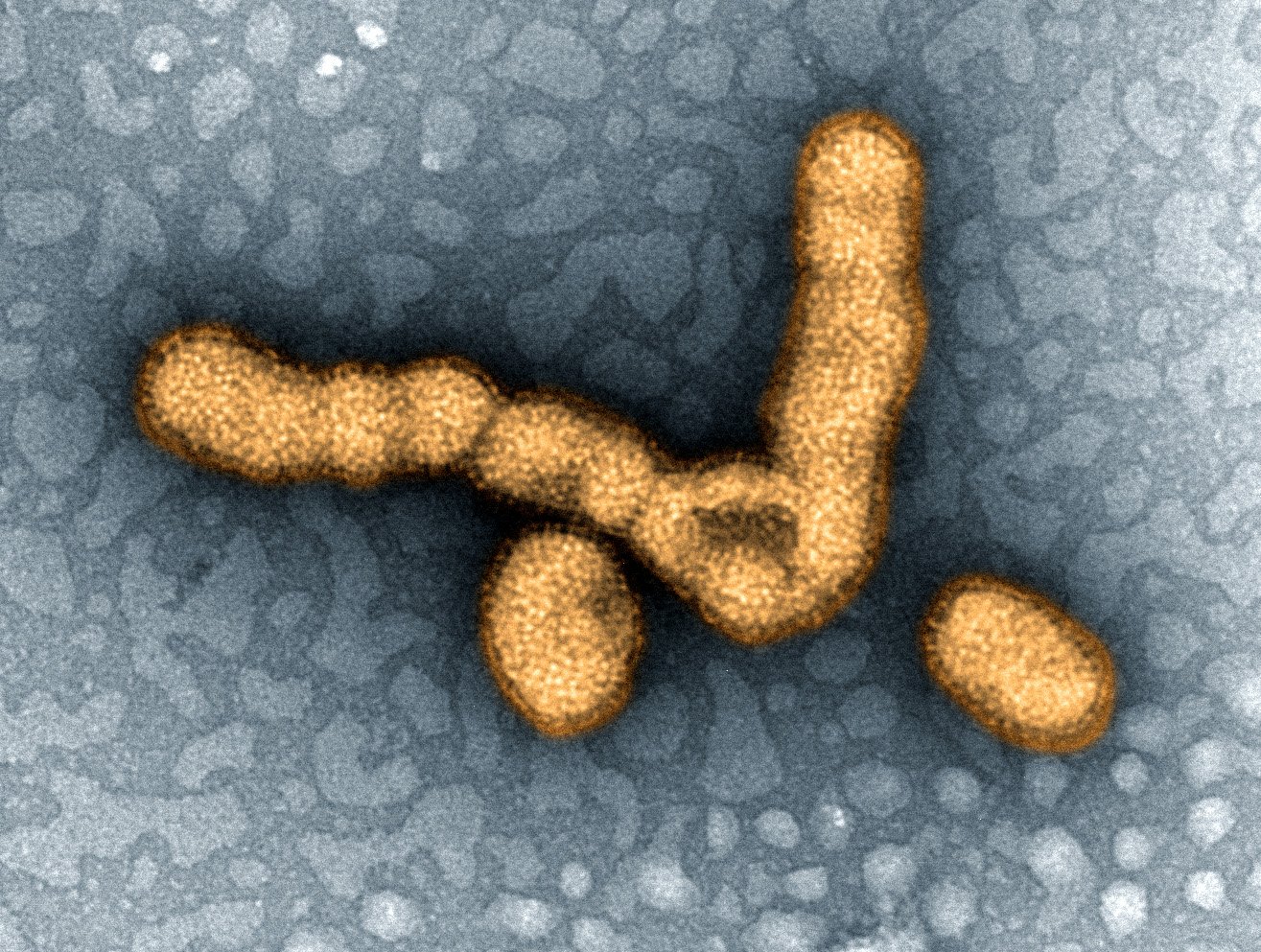 A Virus Like No Other (image credits: wikimedia)