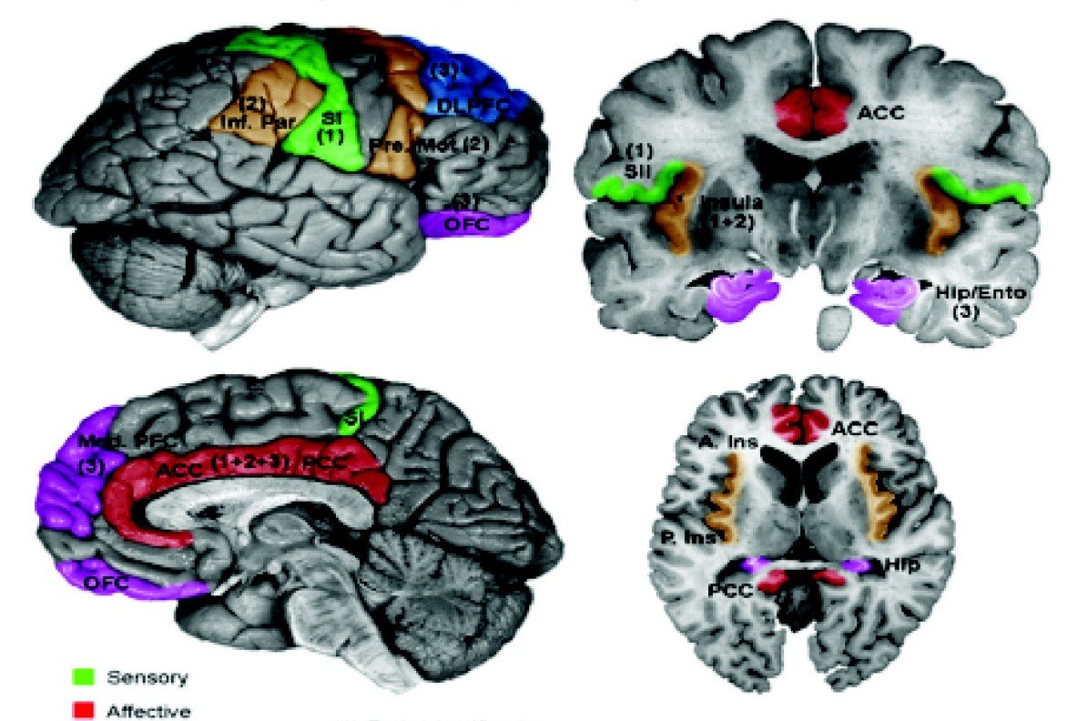 The Science of Pain Perception (image credits: wikimedia)
