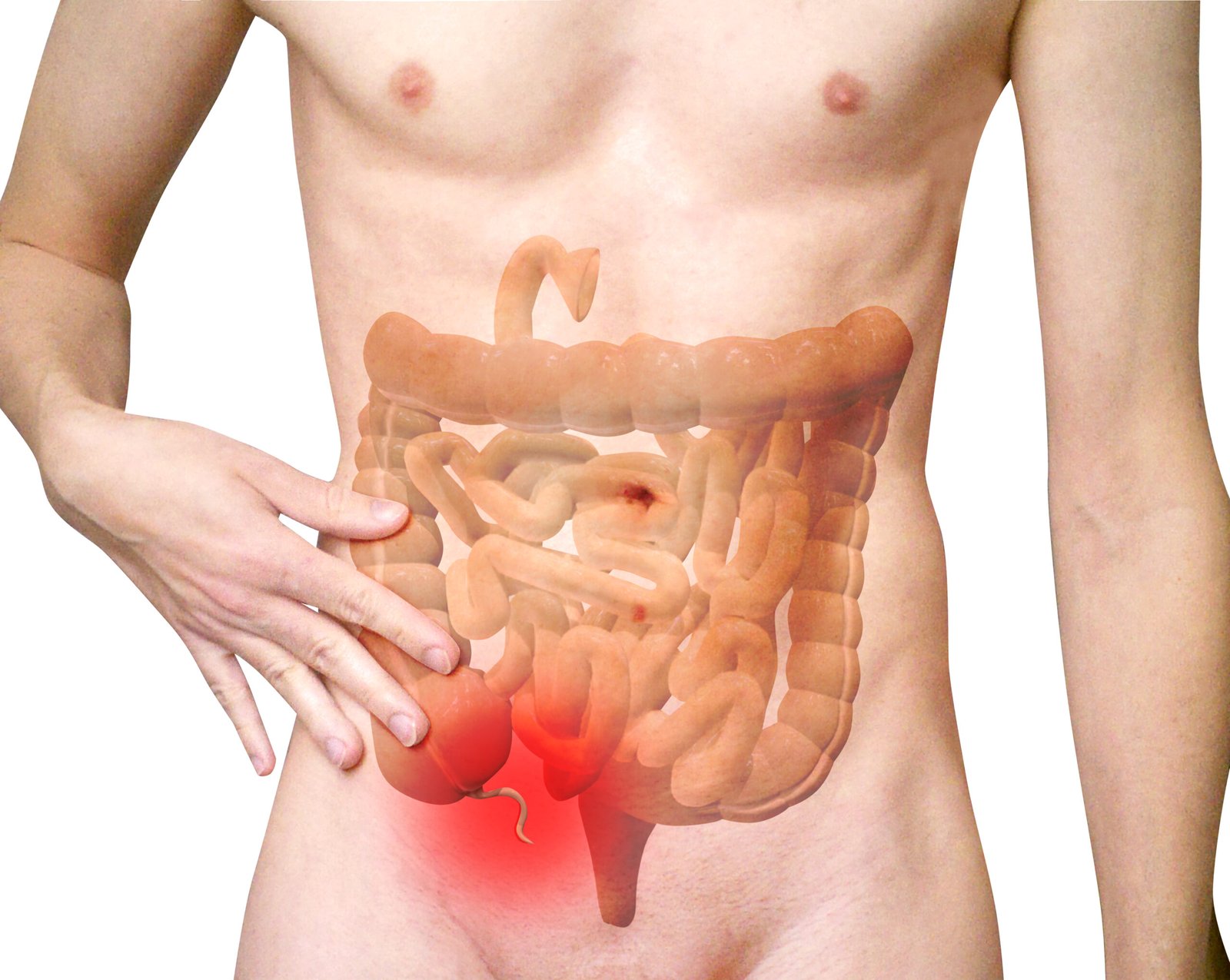 Human Appendix: A Vestigial Mystery (image credits: wikimedia)