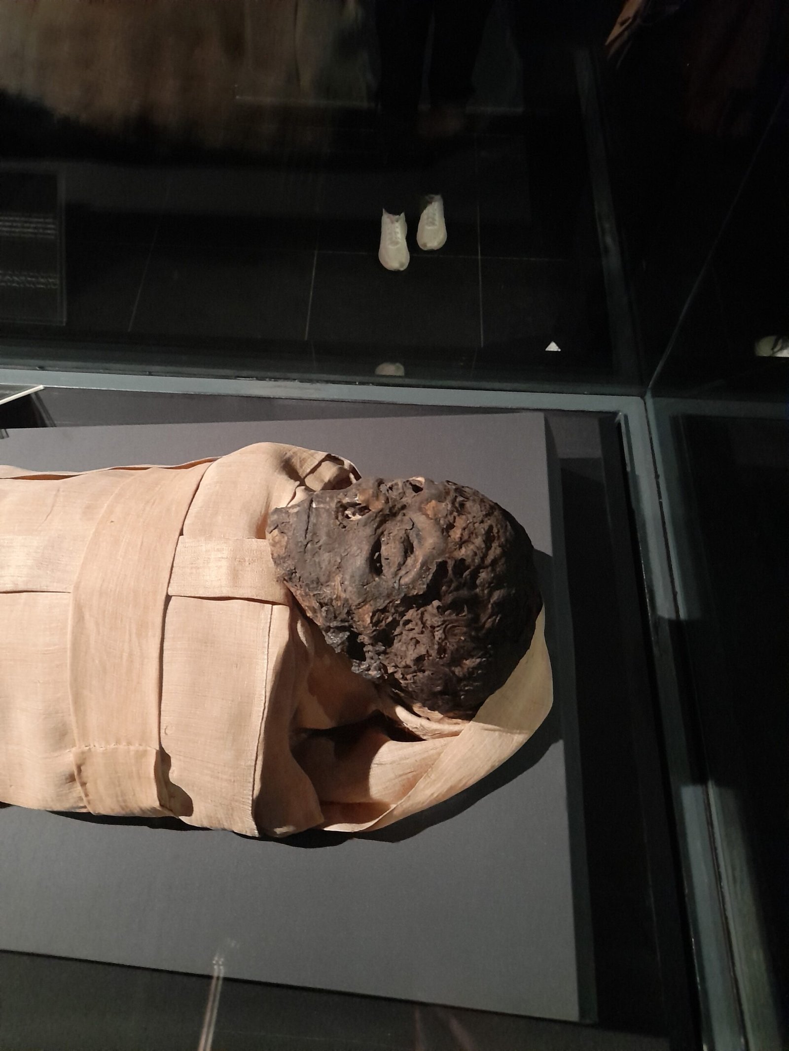 The Remarkable Preservation of Ötzi (image credits: wikimedia)