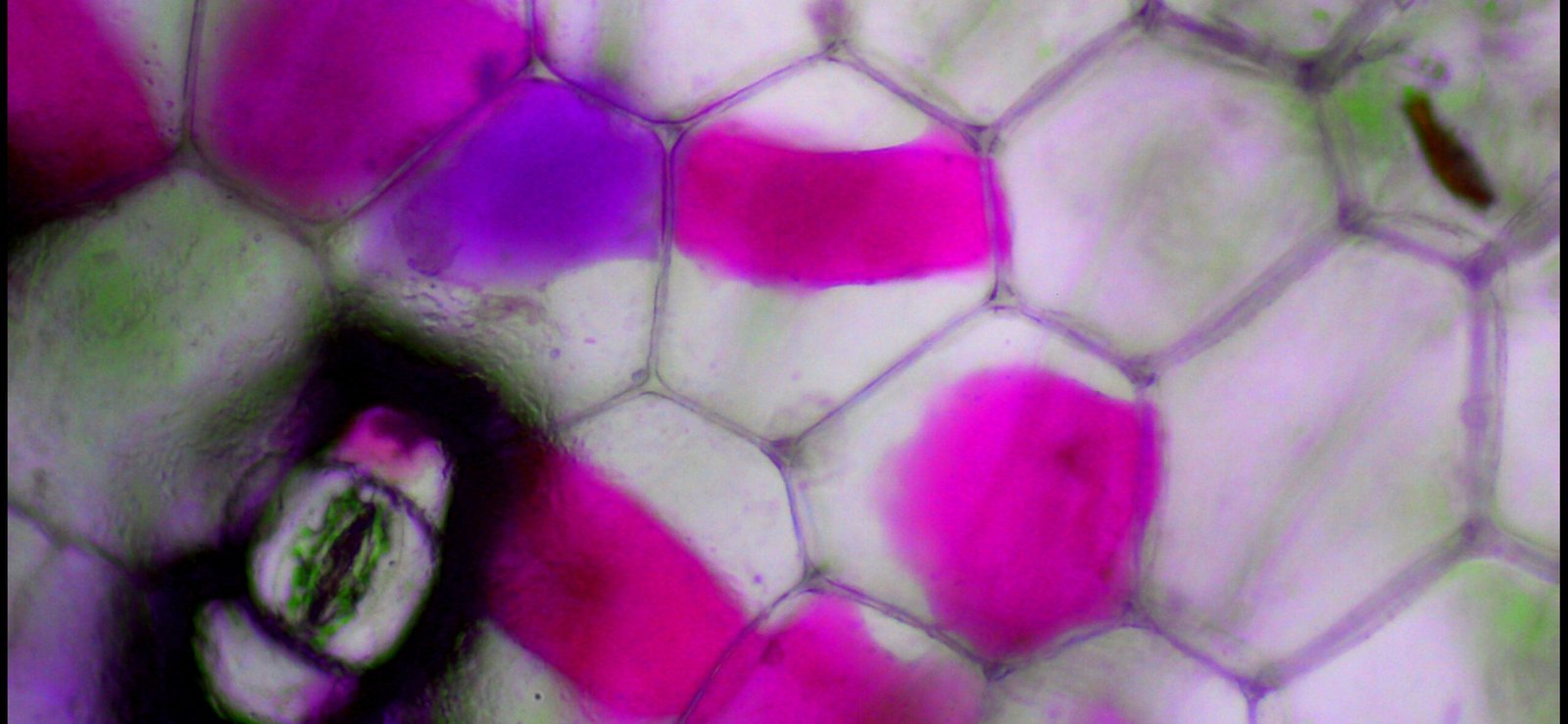 The Significance of Membranes (image credits: wikimedia)