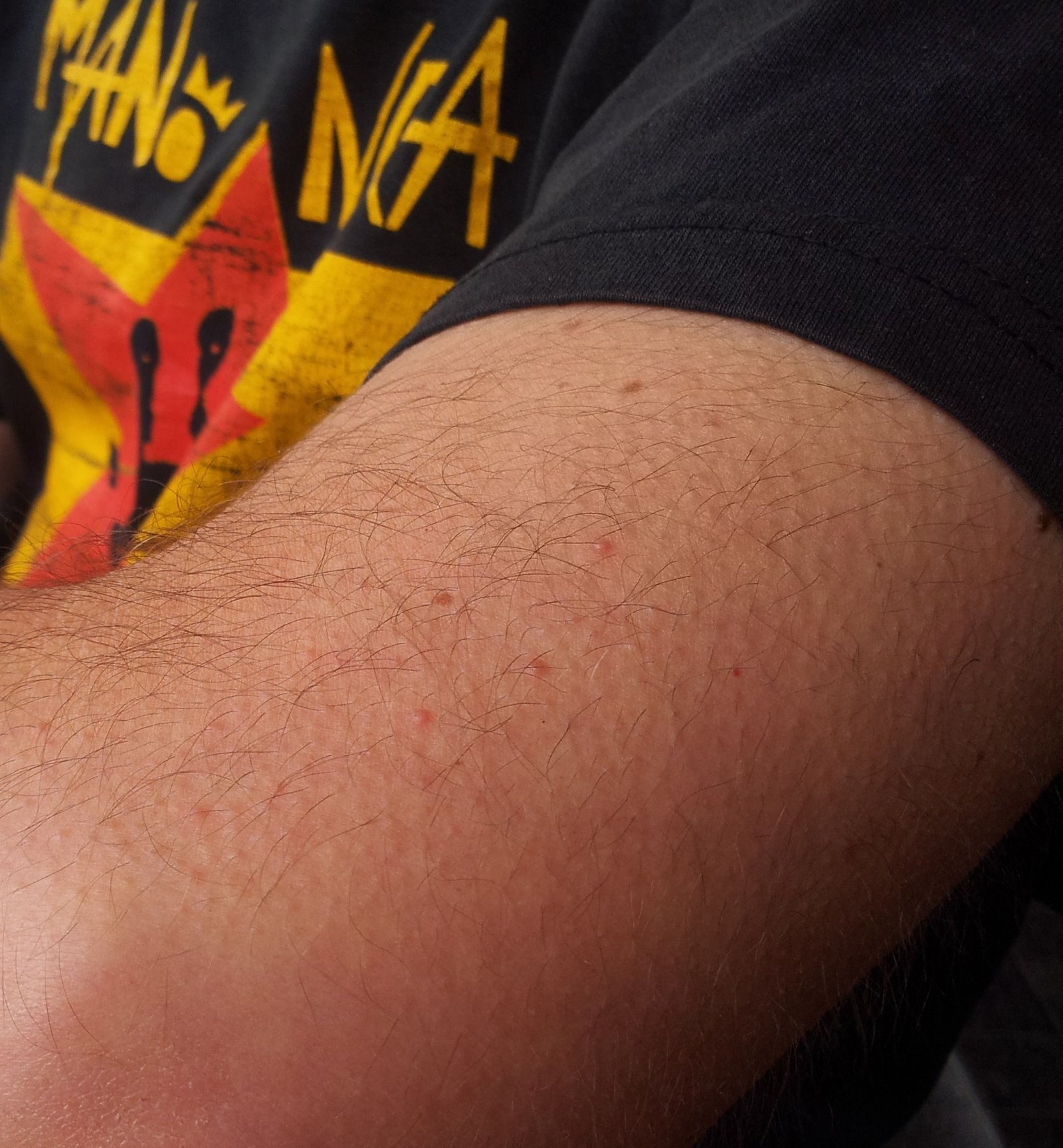 Medical Oddities and When Goosebumps Go Awry (image credits: wikimedia)
