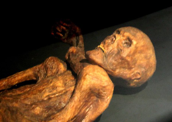 The Ötzi Phenomenon (image credits: wikimedia)