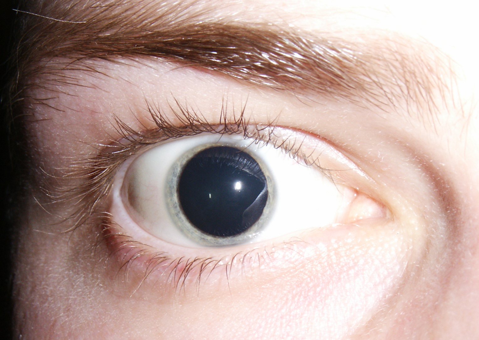 Pupil Size: The Window to Emotion (image credits: wikimedia)