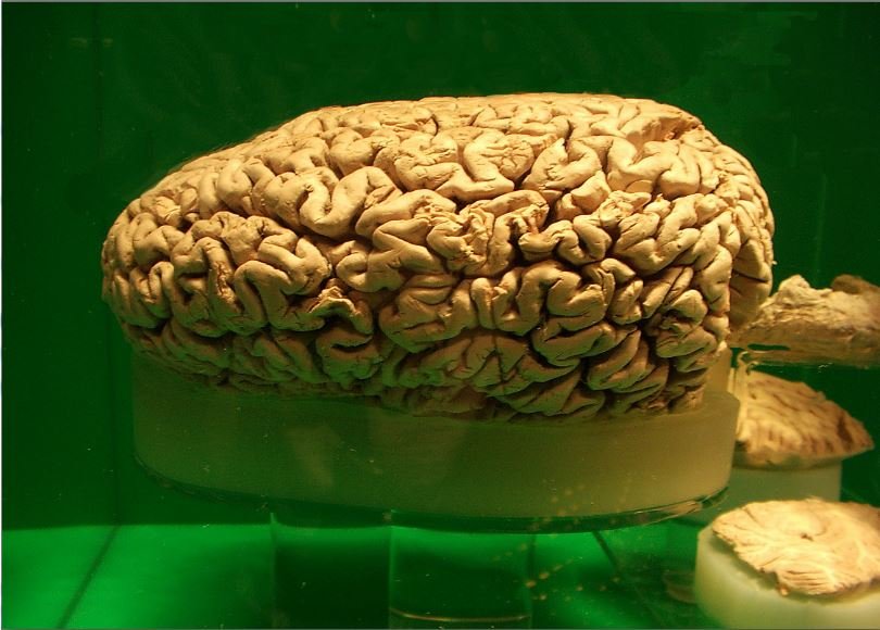 The Colossal Brain: A Record-Breaking Organ (image credits: wikimedia)