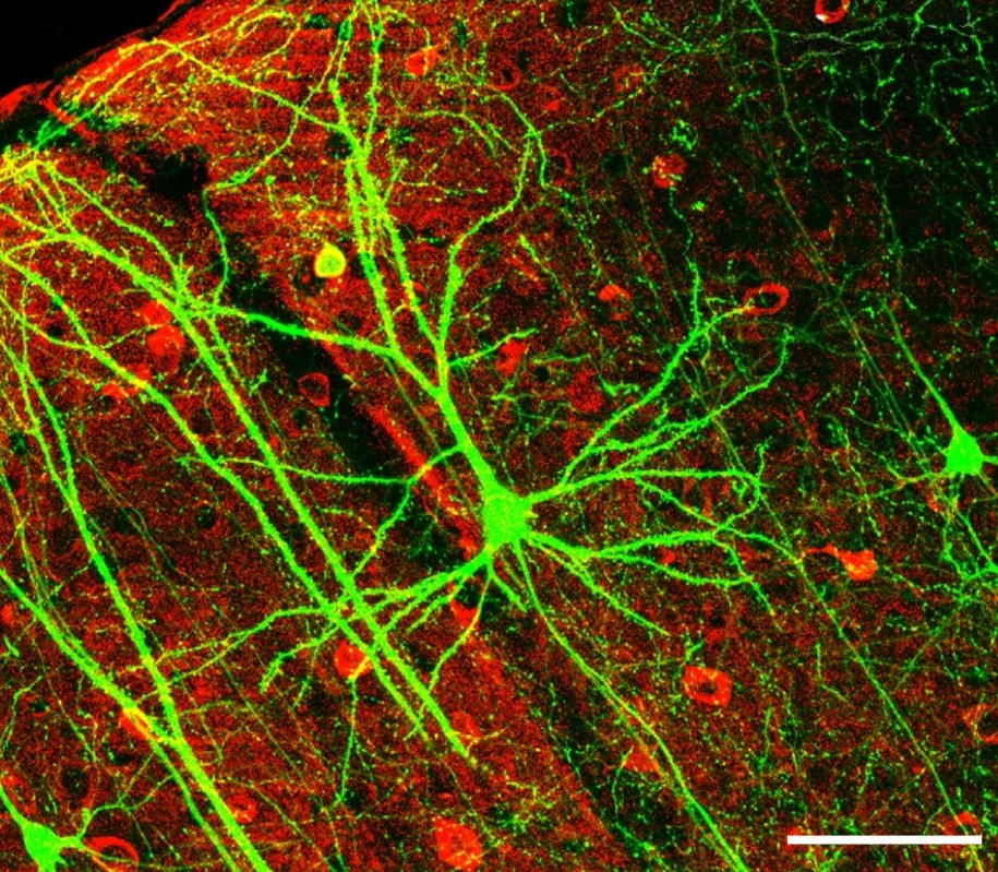 What Is a Nervous System? (image credits: wikimedia)