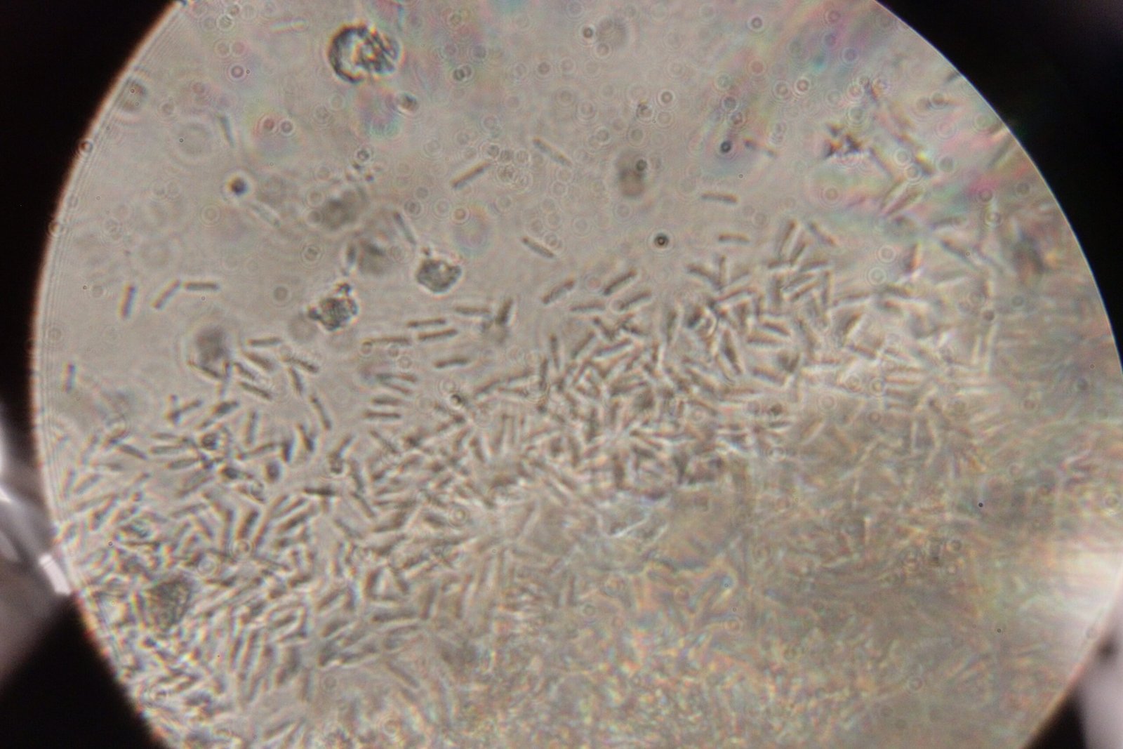 Spreading the Infection: The Fungal Life Cycle (image credits: wikimedia)