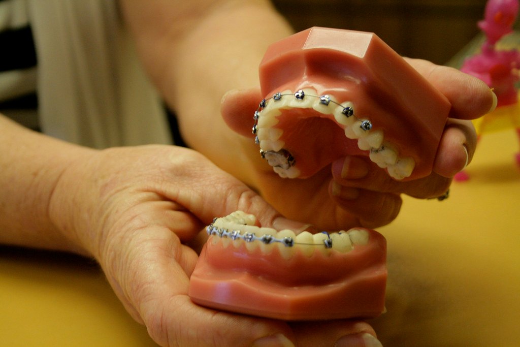 Human teeth