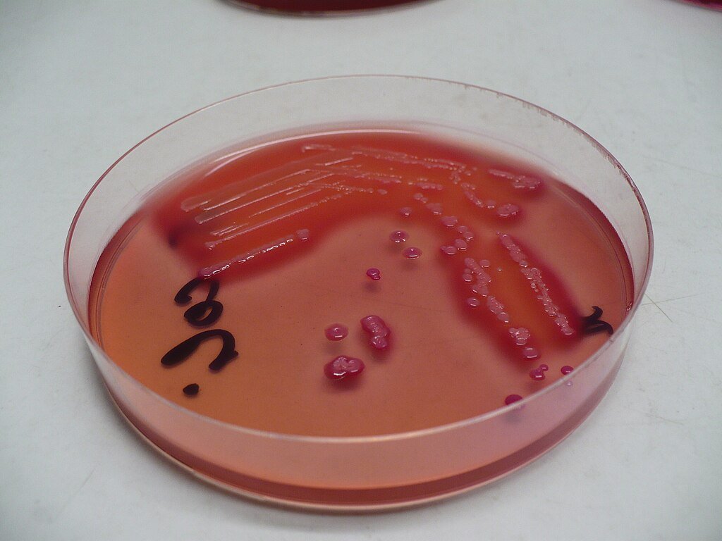Cultivation of Escherichia coli on deoxycholate-citrate agar