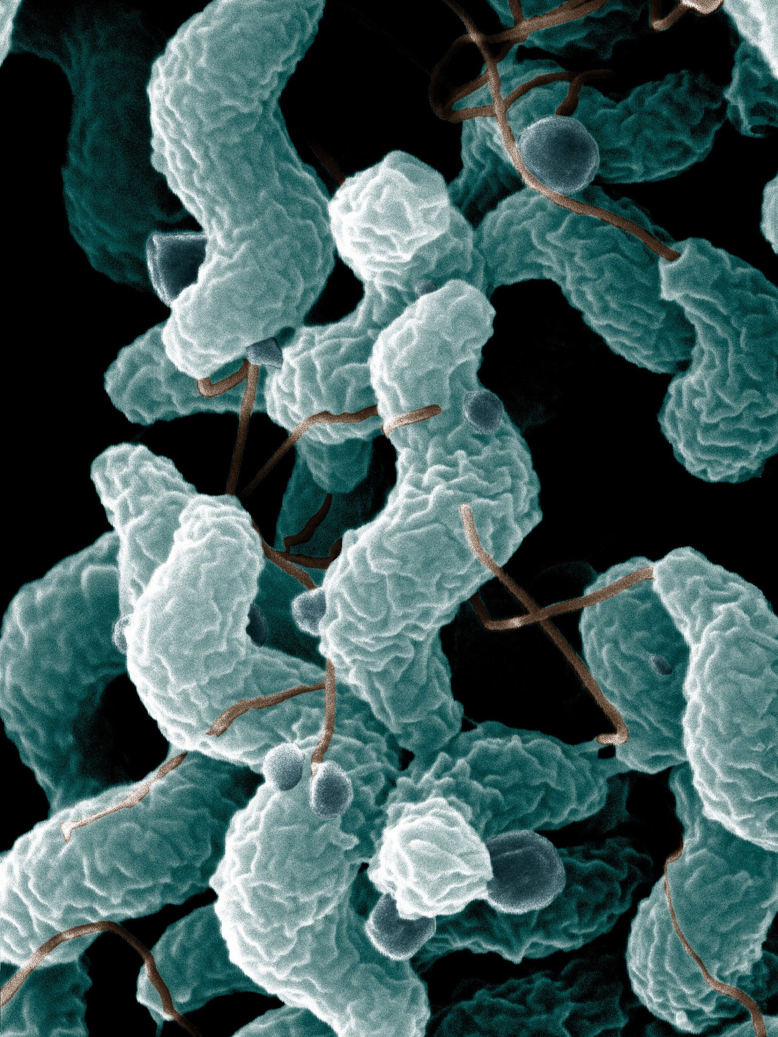 Acid-Loving Microbes: Masters of the Impossible (image credits: wikimedia)
