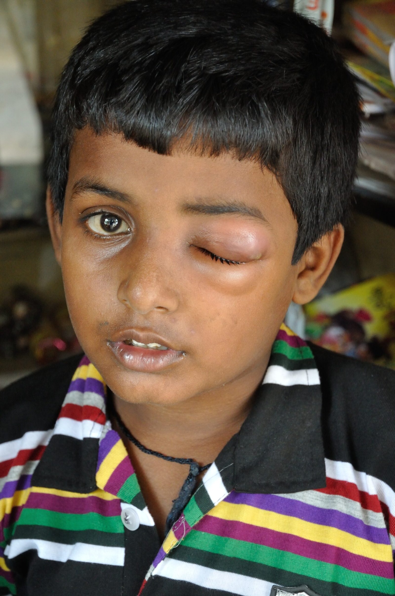 Treatment: A Grueling Battle (image credits: wikimedia)