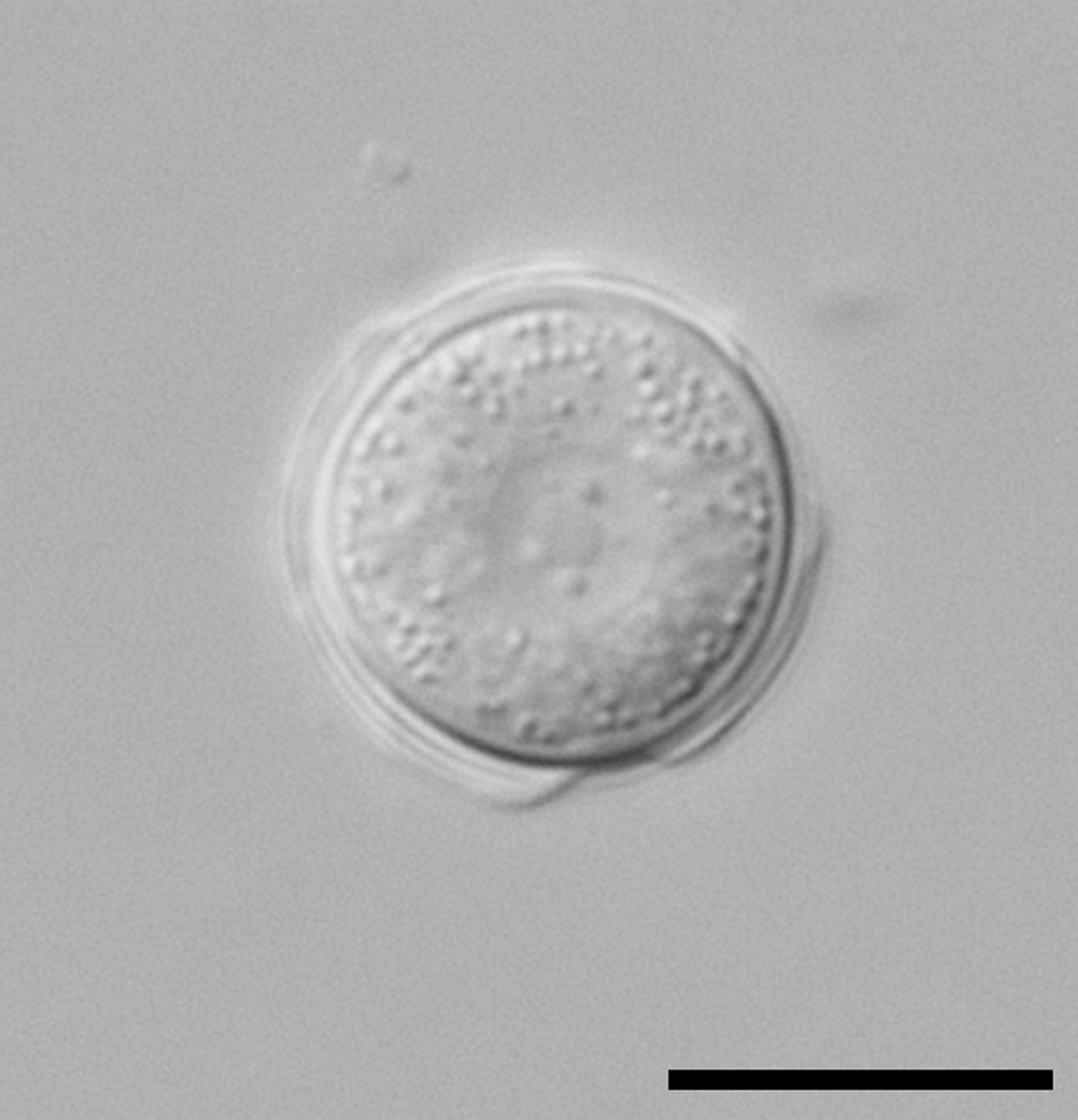 The Resilience of Acanthamoeba: Why It’s So Hard to Kill (image credits: wikimedia)