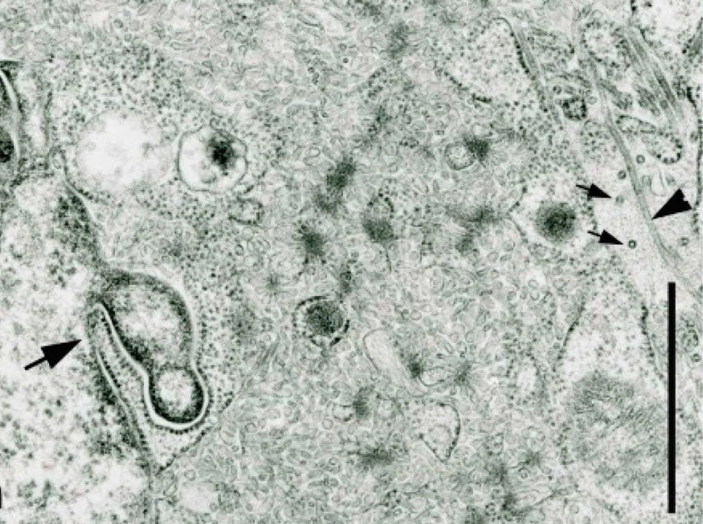 What Makes a Virus “Giant”? (image credits: wikimedia)