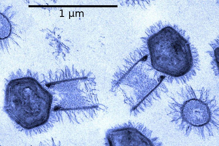 Why the Giant Virus Is So Unusual (image credits: wikimedia)
