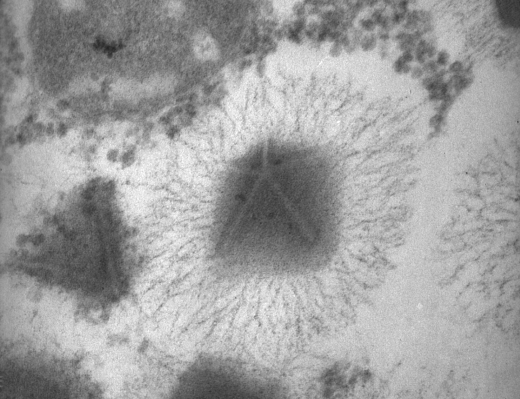 Giant Viruses and Their Unusual Hosts