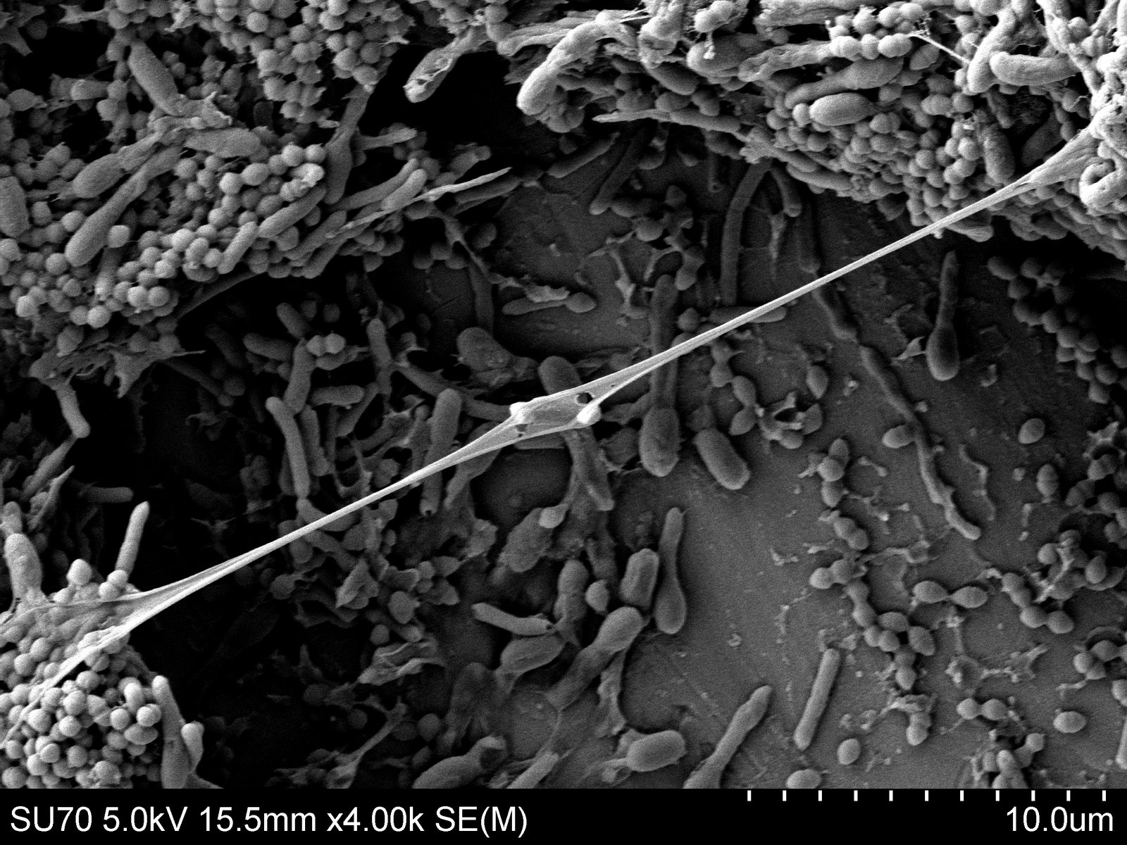 Biofilms: The Power of Bacterial Teamwork (image credits: wikimedia)