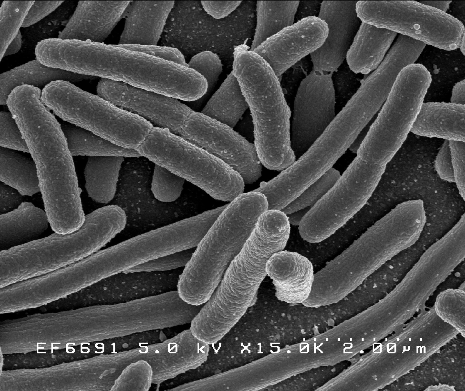Fighting Infection by Interrupting Bacterial ‘Talk’ (image credits: wikimedia)