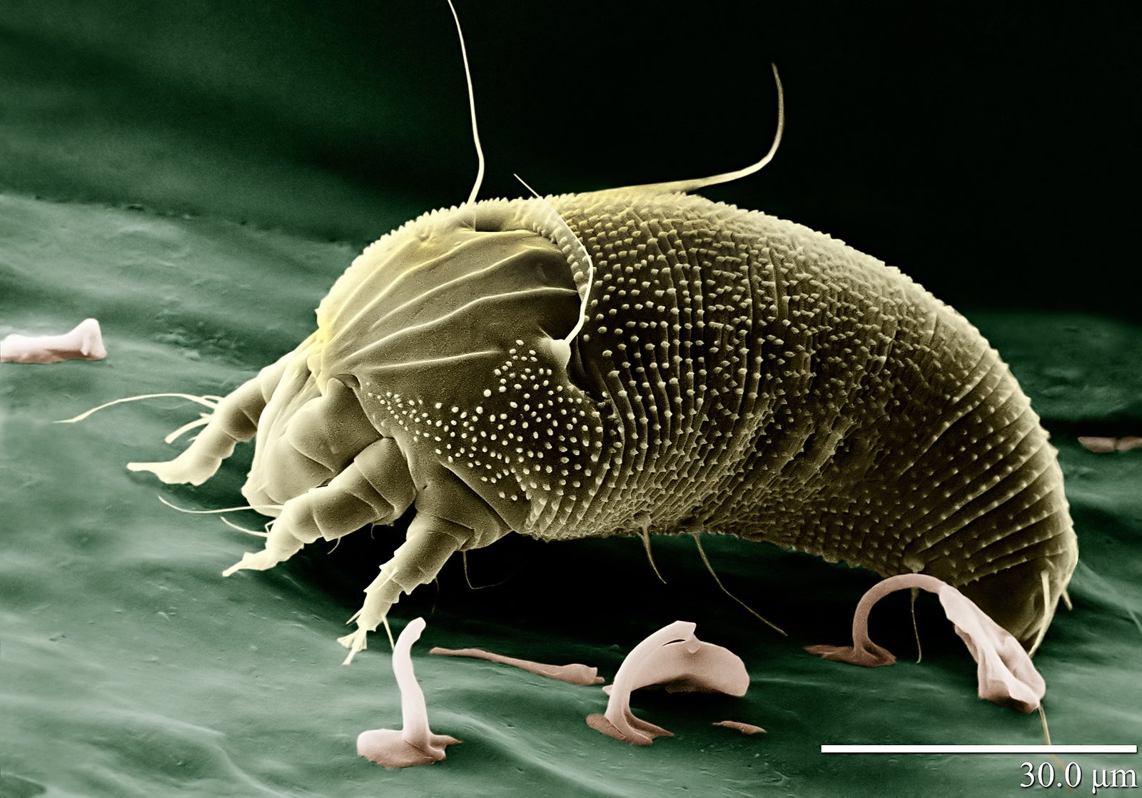 Meet the Microscopic Residents: Mites and Microbes (image credits: wikimedia)
