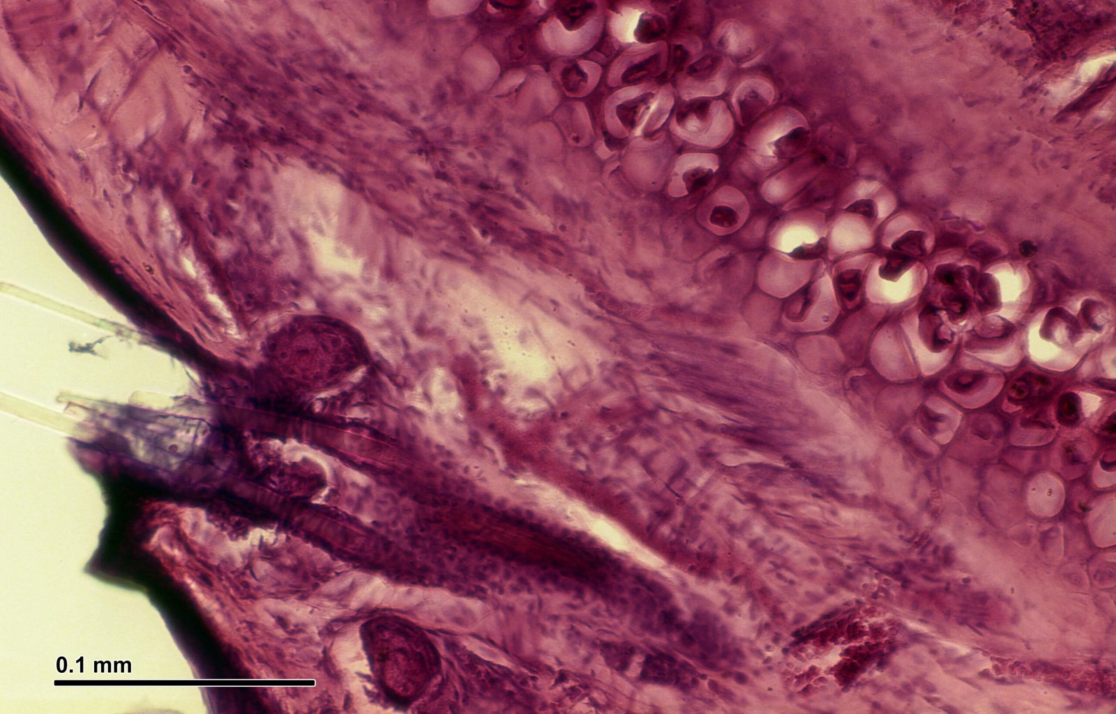 Unseen Beauty: The Artistry of Microscopic Skin Worlds (image credits: wikimedia)