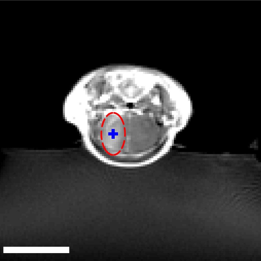 The Mice with Human Brains (image credits: wikimedia)