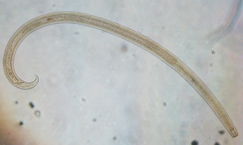 The Role of Nematodes in the Soil Ecosystem (image credits: wikimedia)
