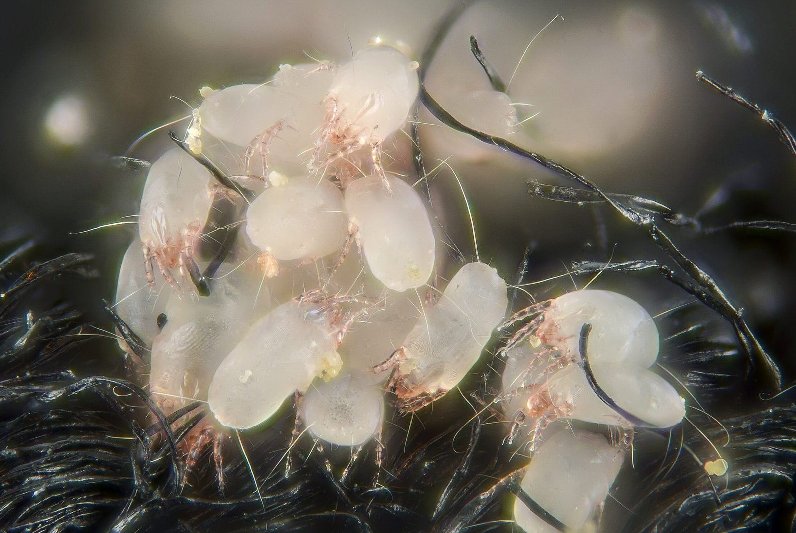 Feasting on Your Shed Skin: A Mite’s Favorite Meal (image credits: wikimedia)