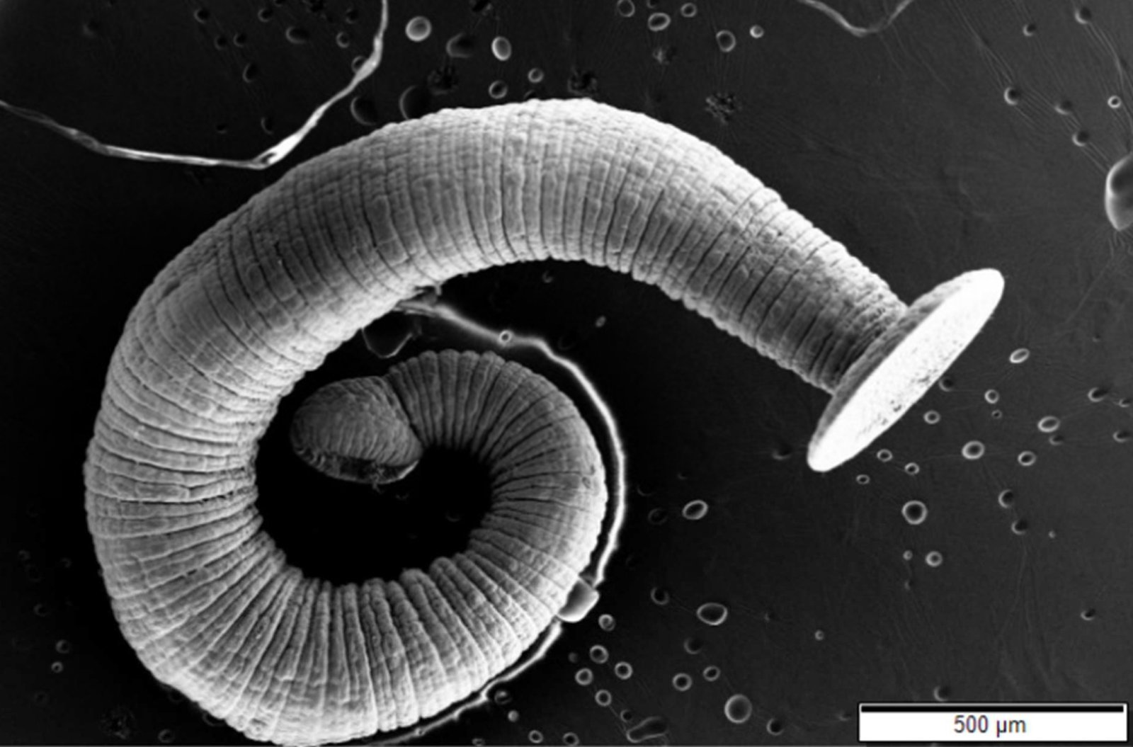 The Intriguing World of Tapeworms (image credits: wikimedia)