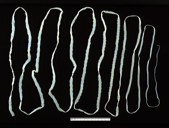 How Do Tapeworms Enter the Human Body? (image credits: wikimedia)