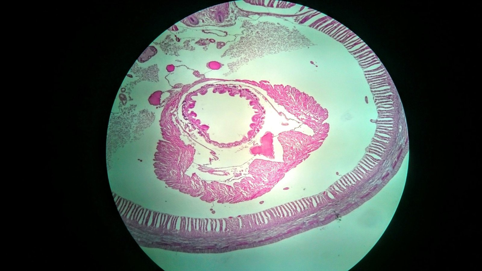 The Global Reach of Tapeworm Infections (image credits: wikimedia)