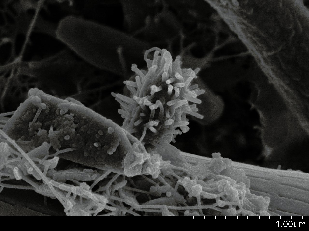 The Biofilm Fortress: Microbial Cooperation (image credits: wikimedia)
