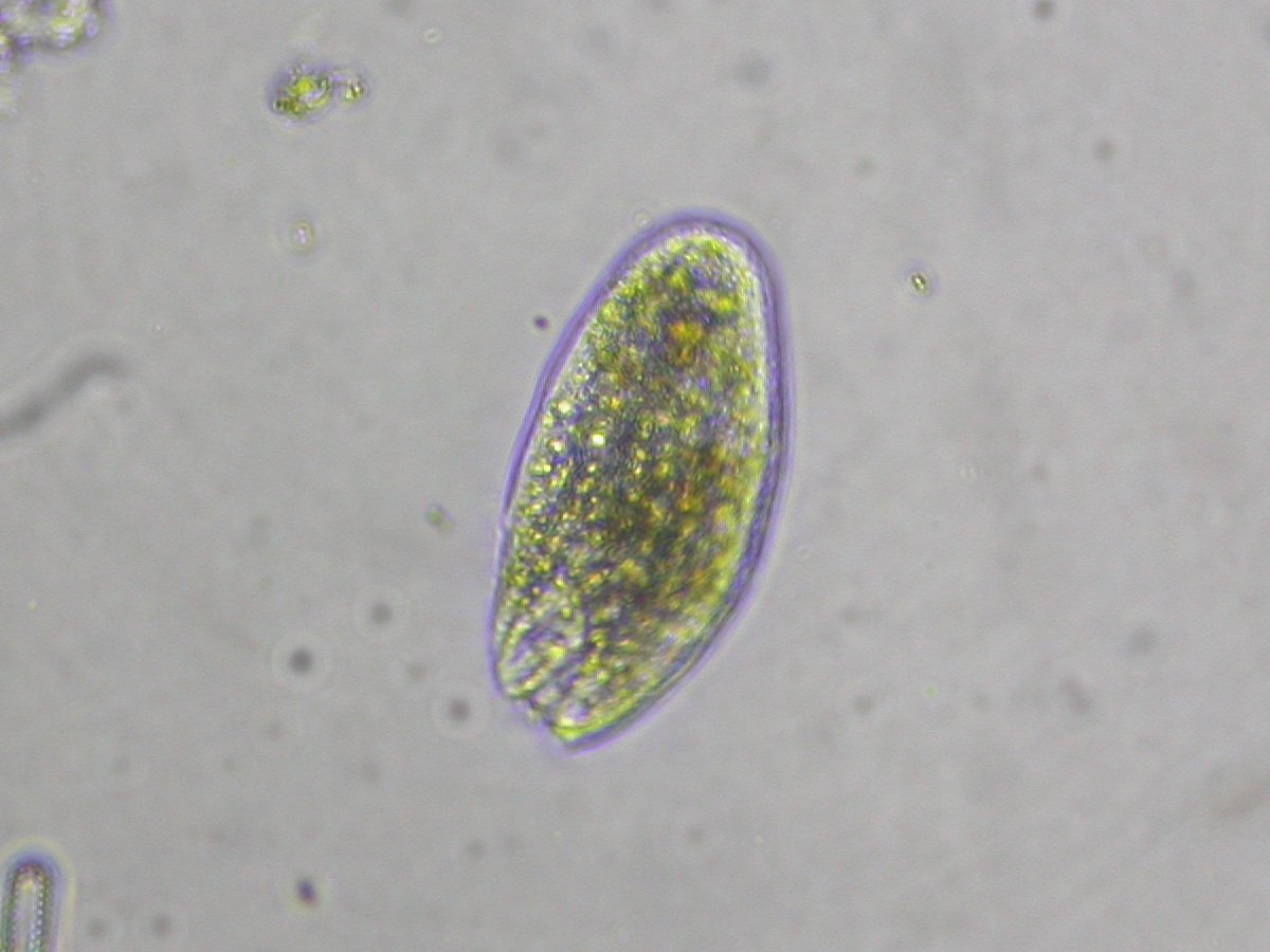 Protozoa: Tiny Predators and Cleaners (image credits: wikimedia)