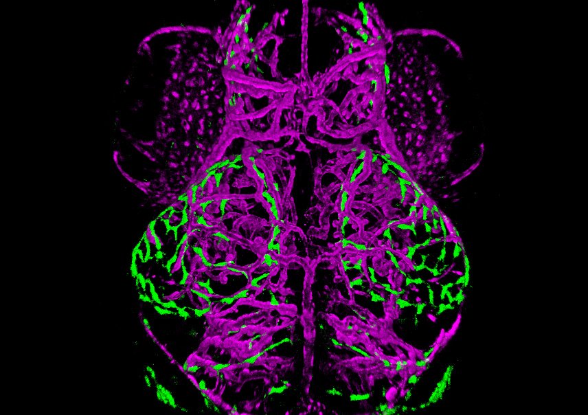 Childhood and Brain Development (image credits: wikimedia)