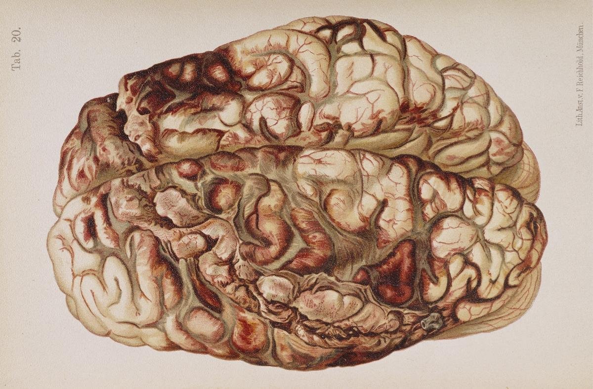 Could Our Brains Shrink Further? (image credits: wikimedia)