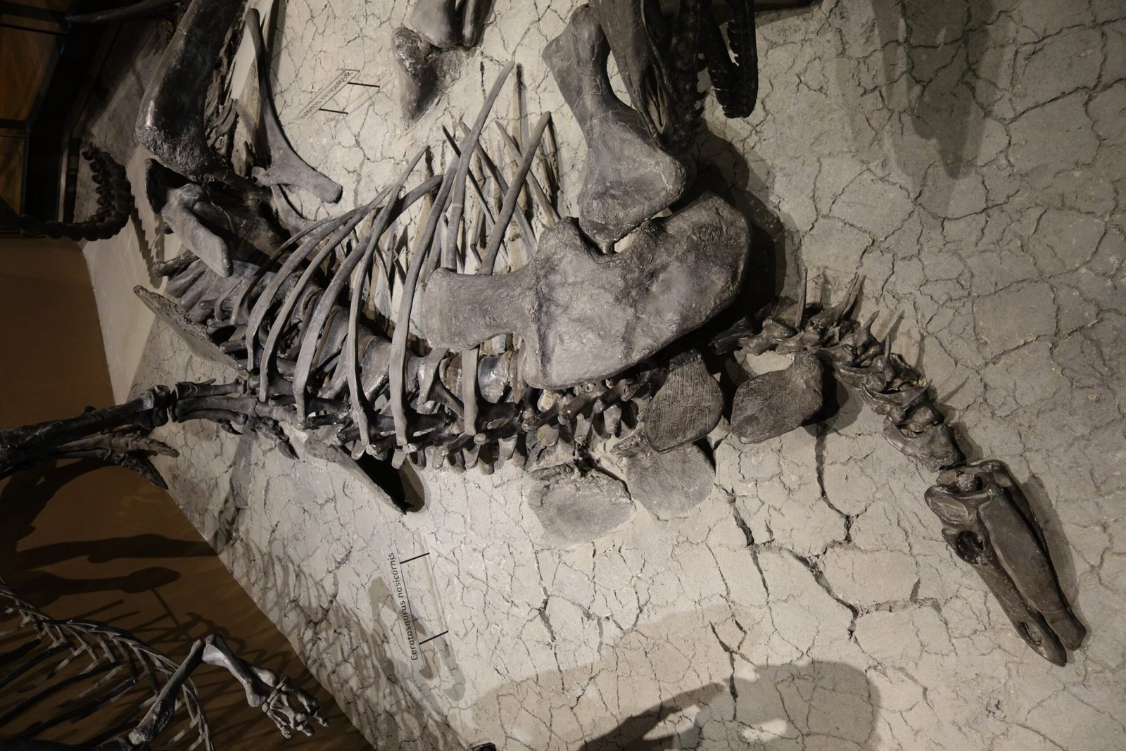 The Anatomy of Confusion: Sacral Enlargement Explained (image credits: wikimedia)