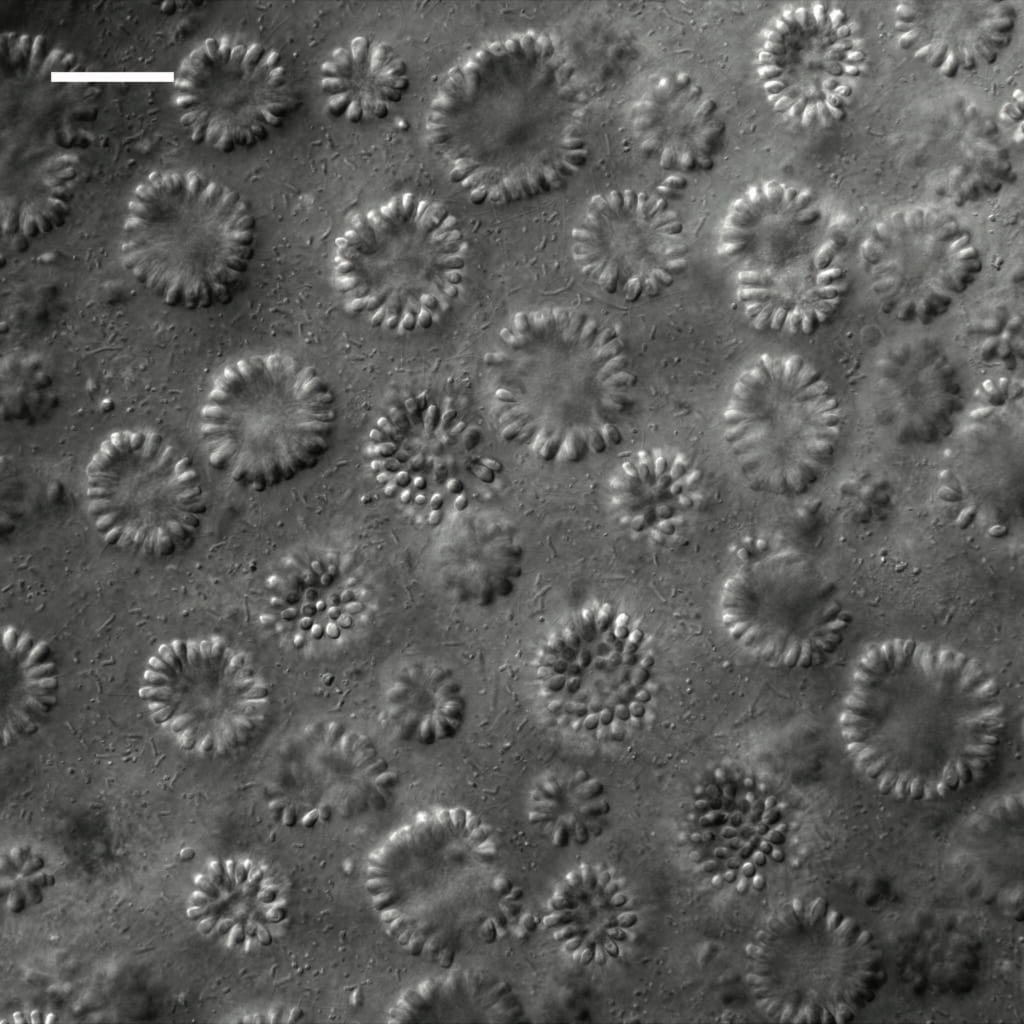 Choanoflagellates: Our Closest Single-Celled Cousins (image credits: wikimedia)