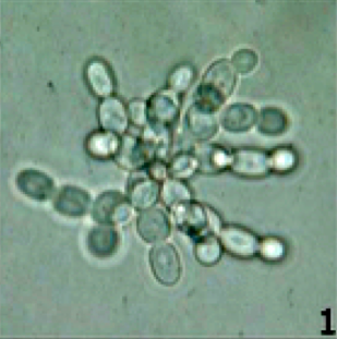 The Microbes That May Have Sparked Multicellular Life on Earth